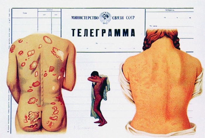Vagričs Bahčanjans. Telegramma